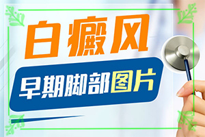 白瘋顛怎么治療[可以用什么來治療]兒童白癩風(fēng)能治好嗎