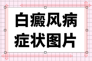 老年人身上起白斑是怎么回事-凍傷過后手上留的白斑怎么醫(yī)治