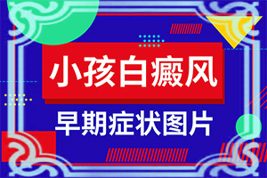 [能控制的方法有]早期白癩風能治療好嗎