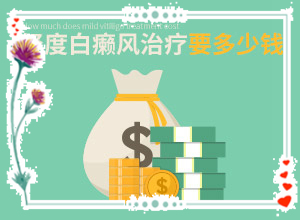 白殿瘋是怎么引起的-八歲小孩臉上長白斑是什么原因
