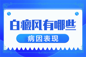 白病癲的癥狀圖片[表現(xiàn)都有些什么]小孩輕度白癩風(fēng)治療