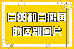 男生私密處出現(xiàn)白斑是怎么回事,原因是什么(病因有哪些呢)