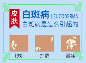 白點(diǎn)癲風(fēng)好治療嗎[治療效果怎么樣]治療兒童癲方法