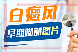 手上局部有兩三處白斑什么原因,幾大病因是什么(什么因素能導(dǎo)致)