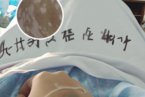白點(diǎn)癲風(fēng)遺傳概率是多少